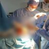 المعهد الوطني المنجي بن حميدة لأمراض الأعصاب :نجاح ثلاث عمليات دقيقة في جراحة الأعصاب للأطفال للرضع بتقنية مبتكرة
