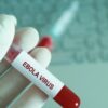 فرنسا تسجل أول إصابة مؤكدة بفيروس “إيبولا”